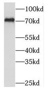 MEPCE Rabbit Polyclonal Antibody