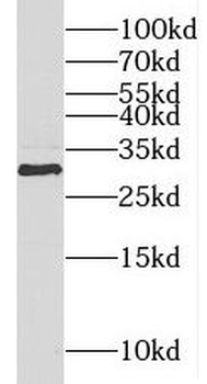 METTL1 Rabbit Polyclonal Antibody