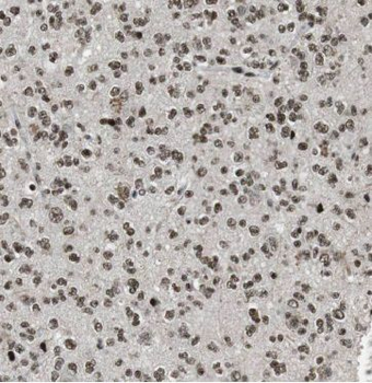 METTL1 Rabbit Polyclonal Antibody