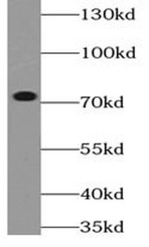 METTL3 Rabbit Polyclonal Antibody