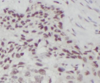 METTL3 Rabbit Polyclonal Antibody