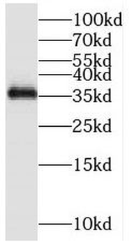 MFAP4 Rabbit Polyclonal Antibody