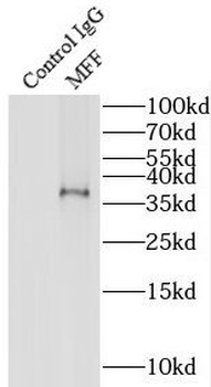 MFF Rabbit Polyclonal Antibody