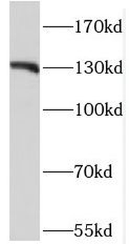 OGA Rabbit Polyclonal Antibody