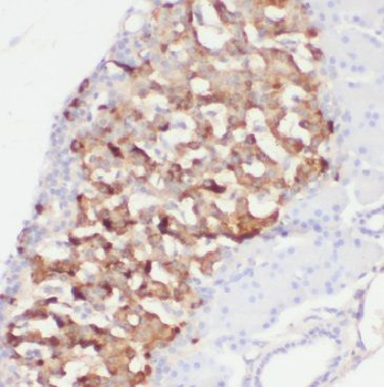 OGA Rabbit Polyclonal Antibody