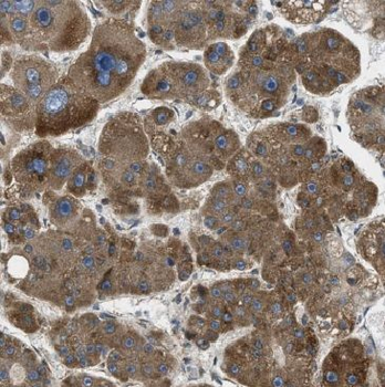 MGLL Rabbit Polyclonal Antibody
