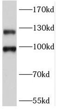 GRM2 Rabbit Polyclonal Antibody