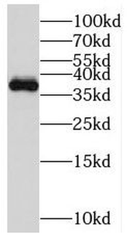 MGME1 Rabbit Polyclonal Antibody