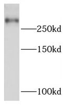 MIA3 Rabbit Polyclonal Antibody