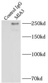 MIA3 Rabbit Polyclonal Antibody