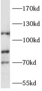 MIB2 Rabbit Polyclonal Antibody
