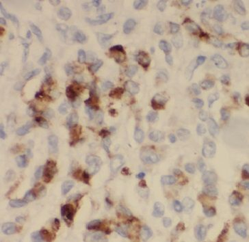 MICAL2 Antibody