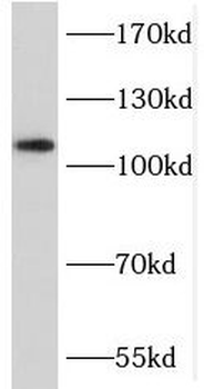 MICALL2 Antibody