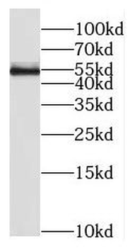 RIOX2 Rabbit Polyclonal Antibody