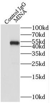 RIOX2 Rabbit Polyclonal Antibody