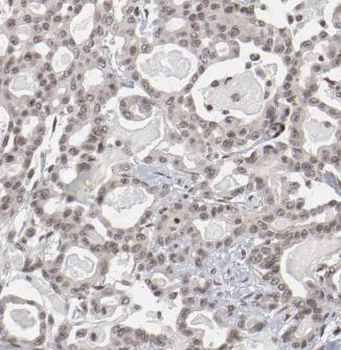 RIOX2 Rabbit Polyclonal Antibody