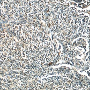 MINK1 Antibody