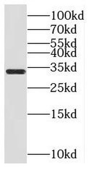MIOX Rabbit Polyclonal Antibody