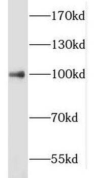 KMT2E Rabbit Polyclonal Antibody