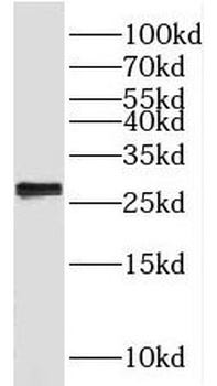 MMAB Rabbit Polyclonal Antibody