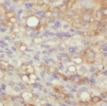 MMAB Rabbit Polyclonal Antibody