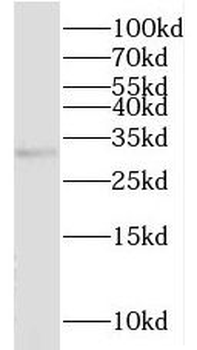MMACHC Rabbit Polyclonal Antibody