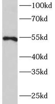 MMP20 Rabbit Polyclonal Antibody