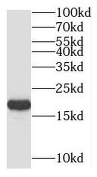 UBE2V2 Antibody