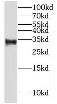 MND1 Rabbit Polyclonal Antibody