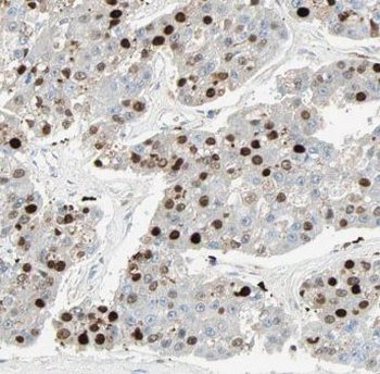 MOB1A Rabbit Polyclonal Antibody