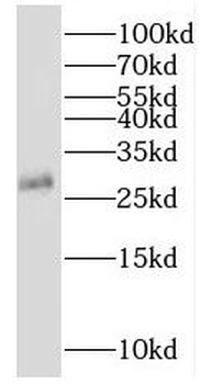 MOG Rabbit Polyclonal Antibody