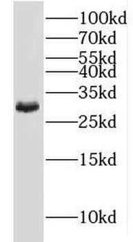 MOGAT2 Rabbit Polyclonal Antibody