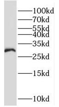 MOGAT2 Rabbit Polyclonal Antibody
