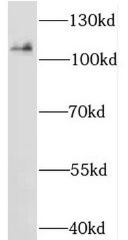 MOV10 Rabbit Polyclonal Antibody