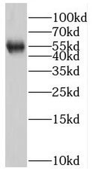 MPP1 Rabbit Polyclonal Antibody