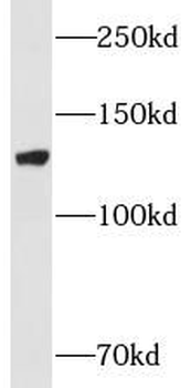 MPRIP Rabbit Polyclonal Antibody