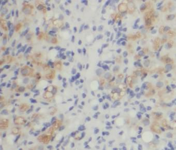 MPRIP Rabbit Polyclonal Antibody