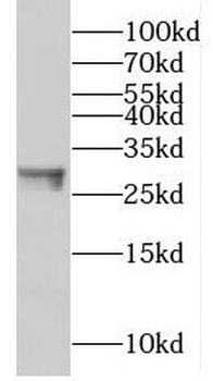 MPZ Rabbit Polyclonal Antibody
