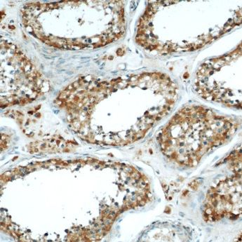 MRAP Rabbit Polyclonal Antibody
