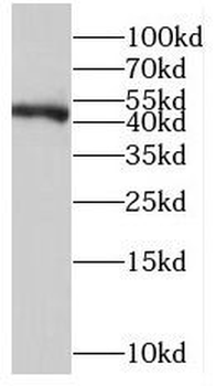 MRI1 Rabbit Polyclonal Antibody