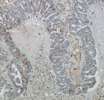 ABCC5 Rabbit Polyclonal Antibody