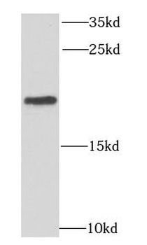 MRPL11 Rabbit Polyclonal Antibody