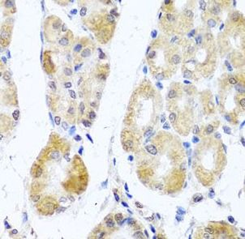 MRPL11 Rabbit Polyclonal Antibody