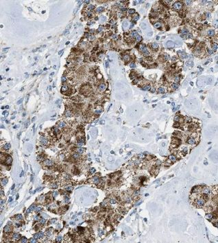 MRPL13 Rabbit Polyclonal Antibody