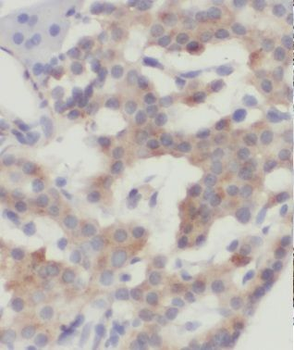 MRPL14 Rabbit Polyclonal Antibody