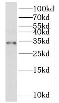 MRPL2 Rabbit Polyclonal Antibody