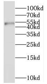 MRPL37 Rabbit Polyclonal Antibody