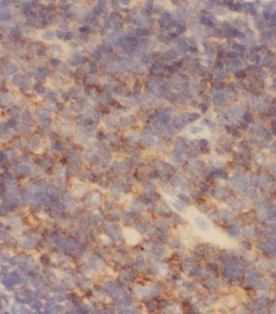 MRPL37 Rabbit Polyclonal Antibody