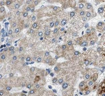 MRPS12 Rabbit Polyclonal Antibody