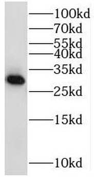 MRPS15 Rabbit Polyclonal Antibody